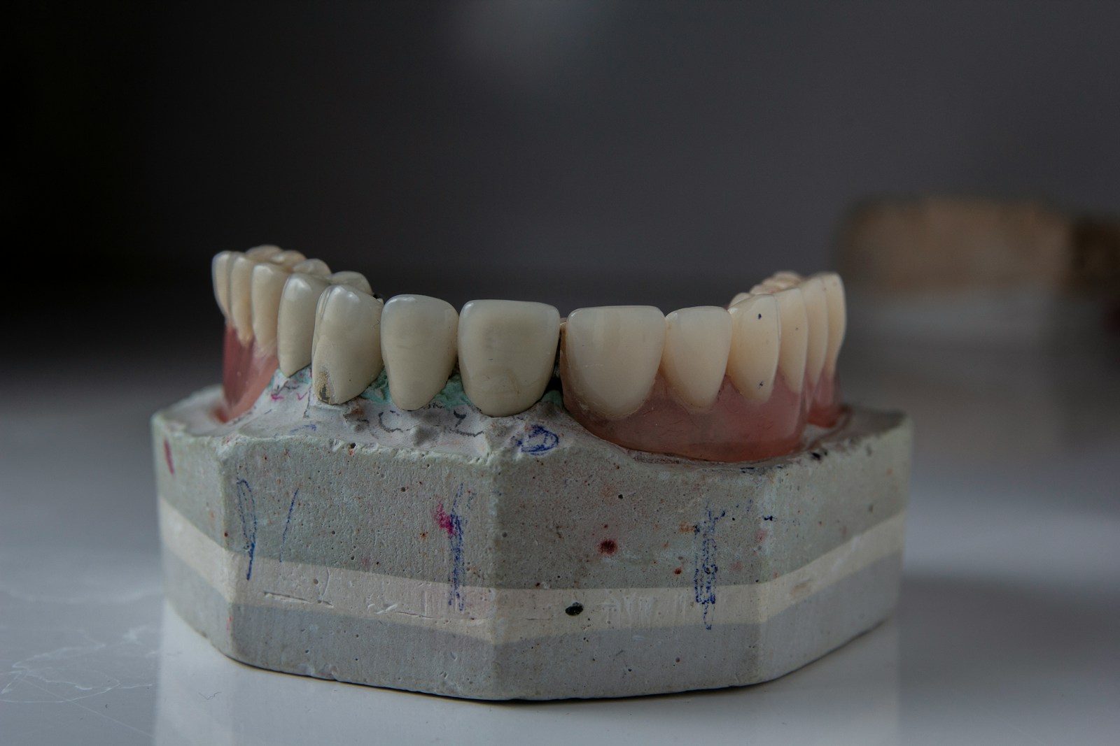 a close up of a tooth model on a table