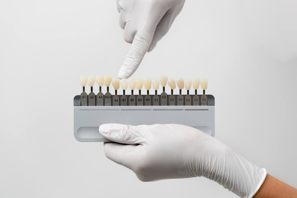 Affordable dental implants