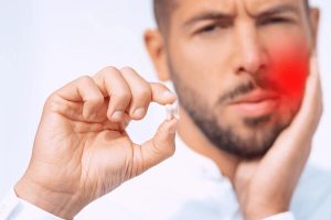 wisdom tooth removal