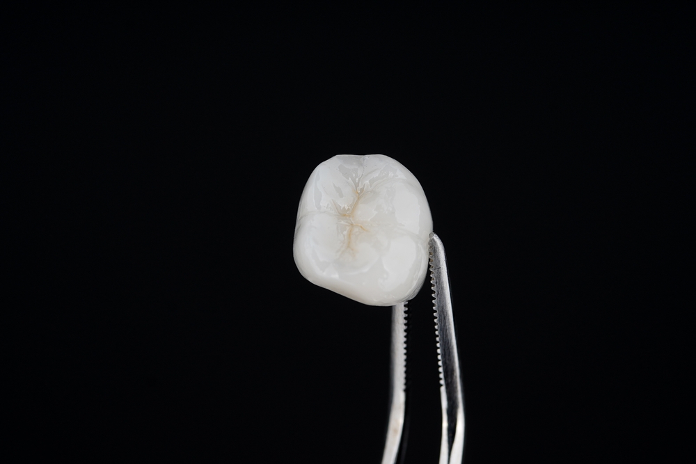 Dental crown being fitted on a tooth
